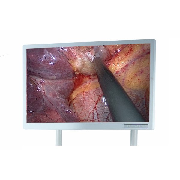 FHD Монітор ЛОКЕМЕД, 21 дюйм